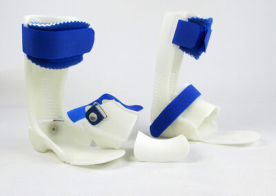 Spitzfuß-Orthesen, hergestellt im 3D-Druck