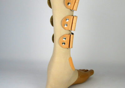 Eine unterschenkellange Fußprothese, hergestellt in Gießharz-Ledertechnik.