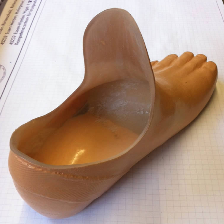Prothese für den Vorfuß aus Silikon
